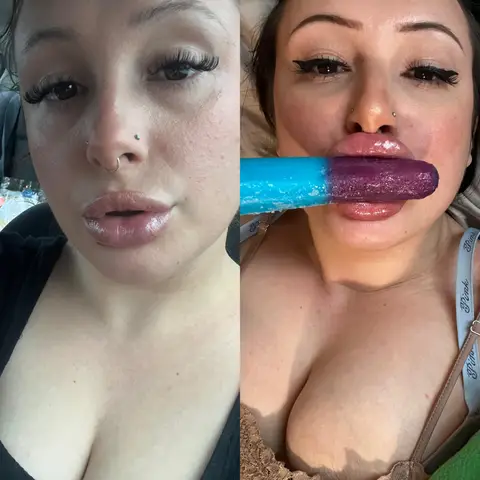 Perfecting my lips and getting my first surgery next week